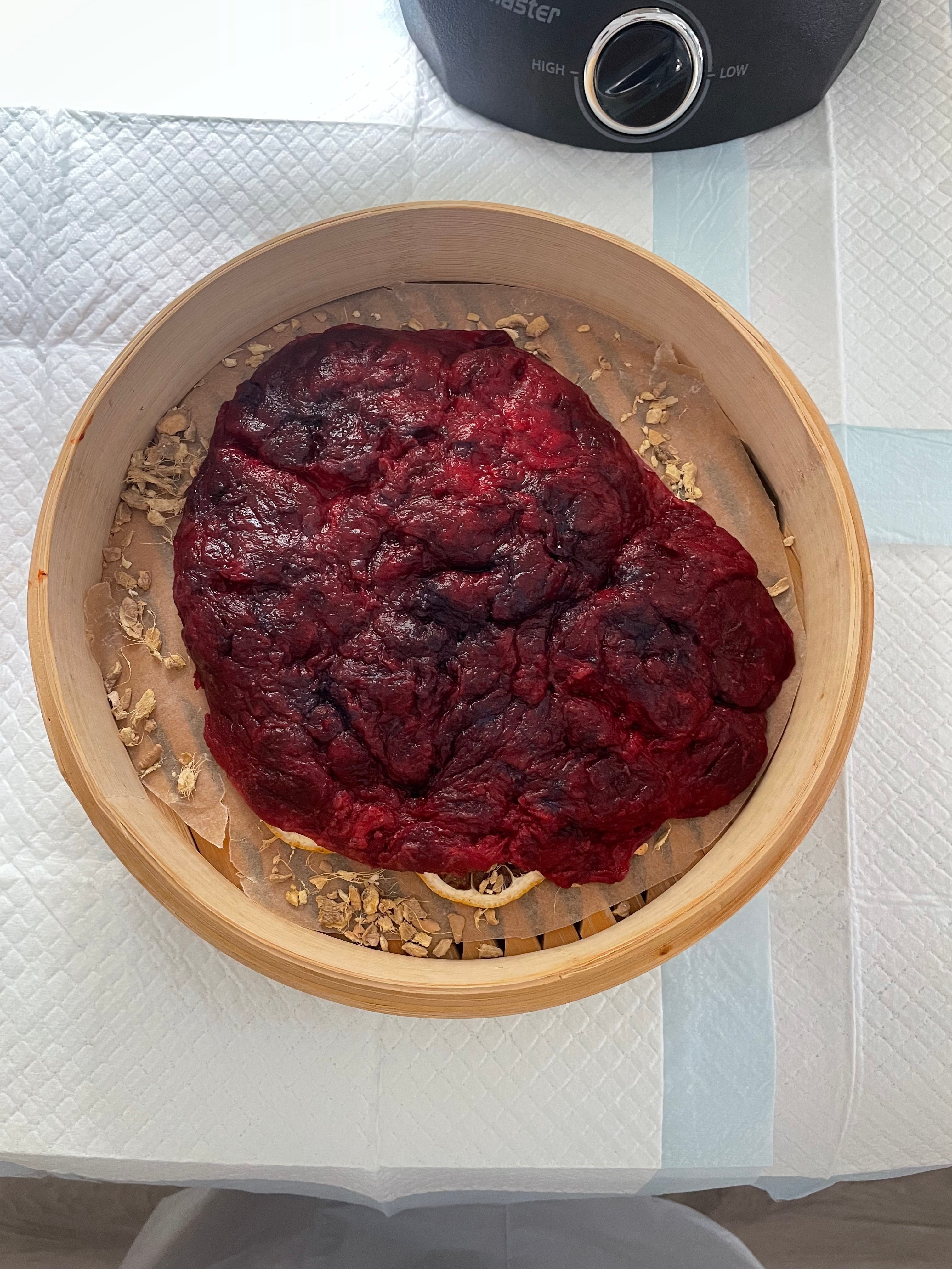 placenta services